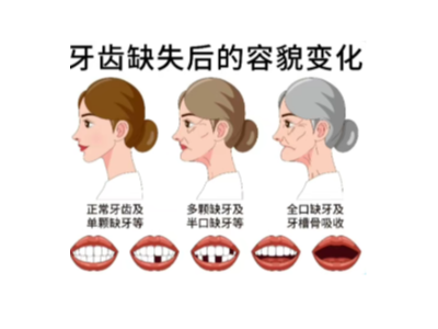 【科學(xué)科普】十個(gè)常用的口腔小知識(shí)！
