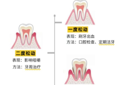 老年人牙齒松動了要怎么辦？