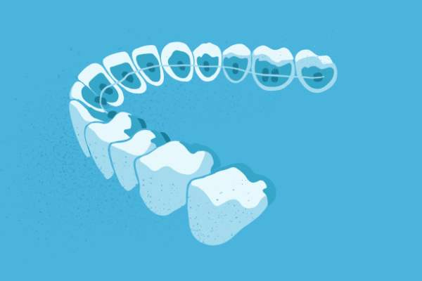 惟德口腔醫(yī)院口腔正畸好不好？